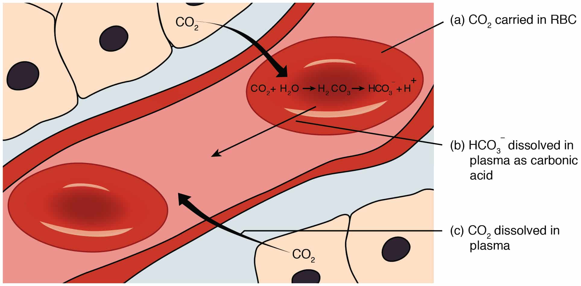 The KetoKick: Ketoacidosis Explained